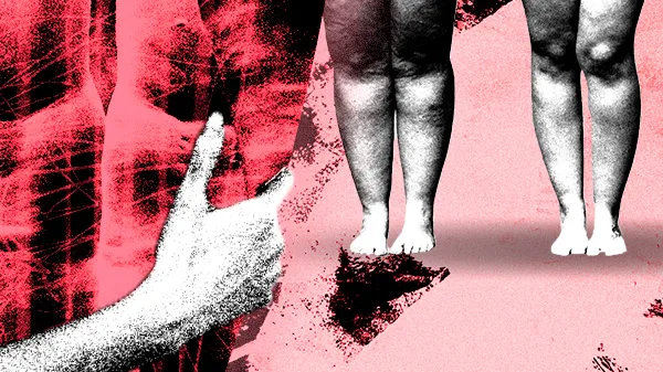 Colagem digital de mão tocando uma perna feminina, com outras pernas de diferentes formas corporais ao redor