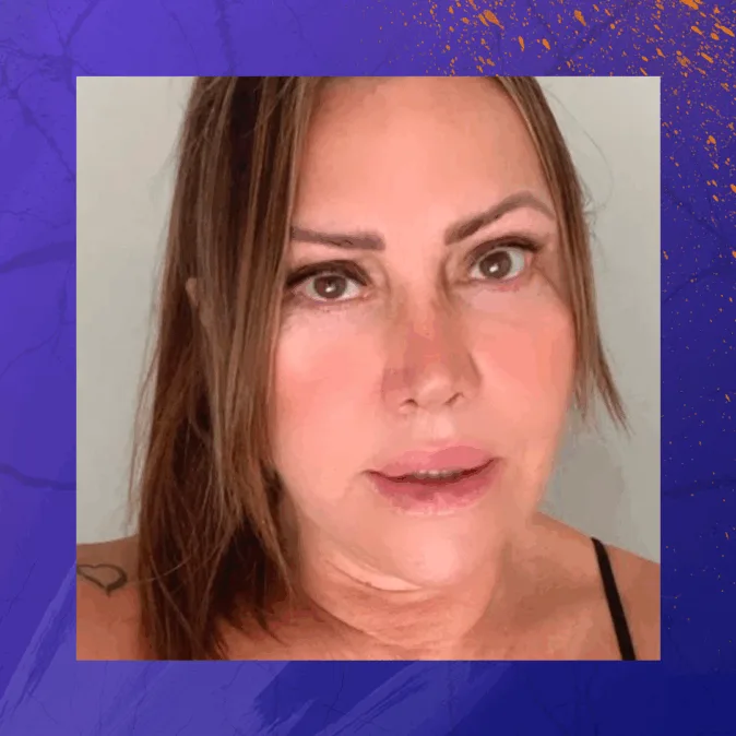 Elaine é uma mulher branca de cabelo castanho claro e pele marcada por cicatrizes sutis no rosto e pescoço encara a câmera com expressão séria. Usa blusa de alça fina preta e aparece com o cabelo parcialmente preso.