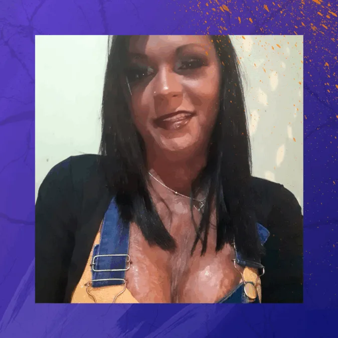 Erika é uma mulher com cabelos lisos e pretos sorri suavemente. Ela veste uma blusa amarela com jardineira jeans e colar prateado. Suas cicatrizes visíveis no rosto, pescoço e colo são marcas de um ataque com fogo, resultado de uma tentativa de feminicídio.